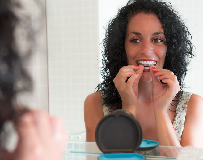 Invisalign