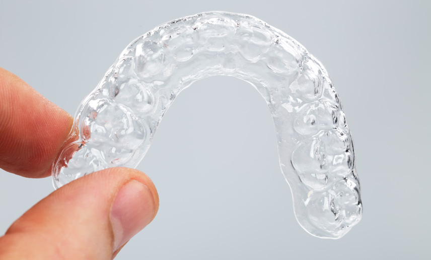 Clear Aligner Costs in Adelaide - What To Expect With Invisalign®